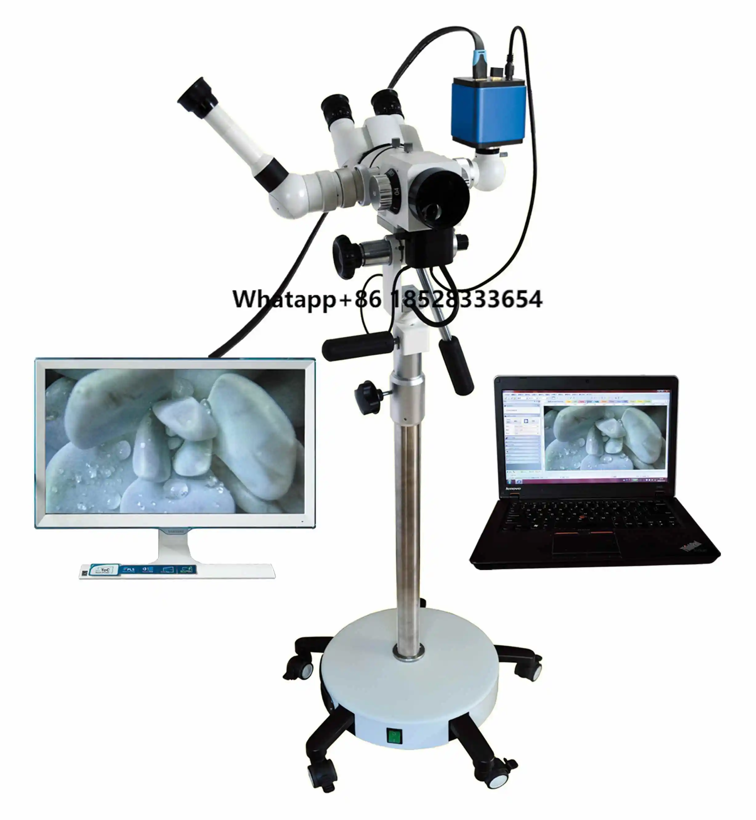 High-end Medical Digital Binocular Microscope Hd Removable Vertical Gynecological Colposcopy