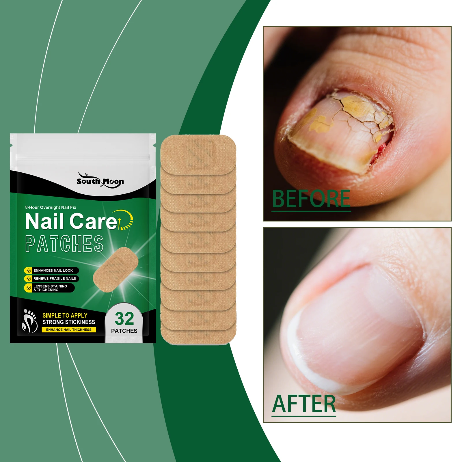 

Toenail Fungus Patch Waterproof Nail Repair Patches Nail Ingrown Correction Sticker Discolored Damaged Nail Foot Care Tool