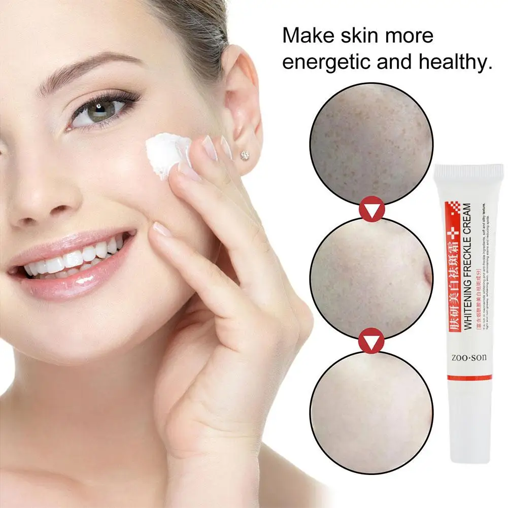 Effective Whitening Freckle Cream Remove Dark Spots Anti Freckle Cream Niacinamide Fade Pigmentation Melasma Brighten Creams