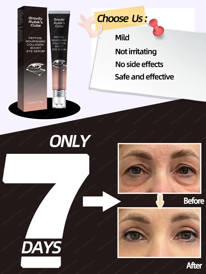 

dark circles device