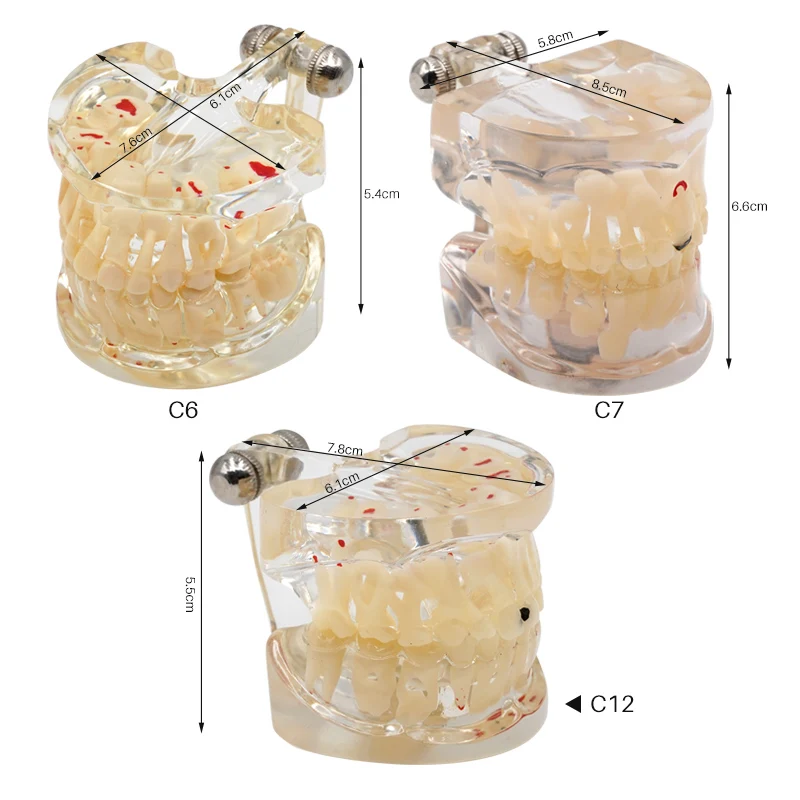 Dental Teeth Model Child Lactic Constant Alternating Model Kid Milk Permanent Study Demonstration Standard Dentist Student Model