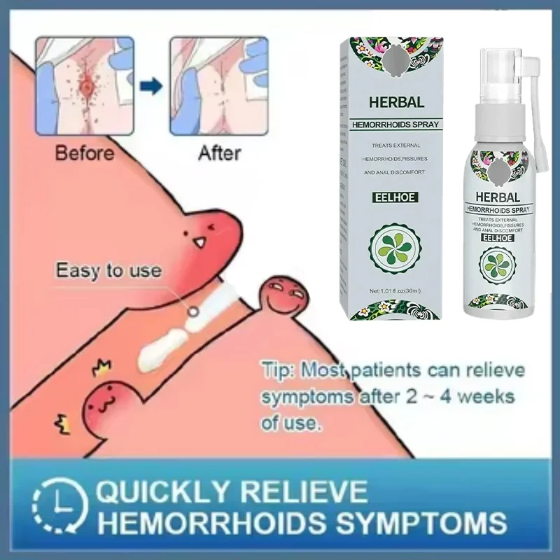 Эффективный крем для удаления геморроя от анального и ануса с натуральными экстрактами