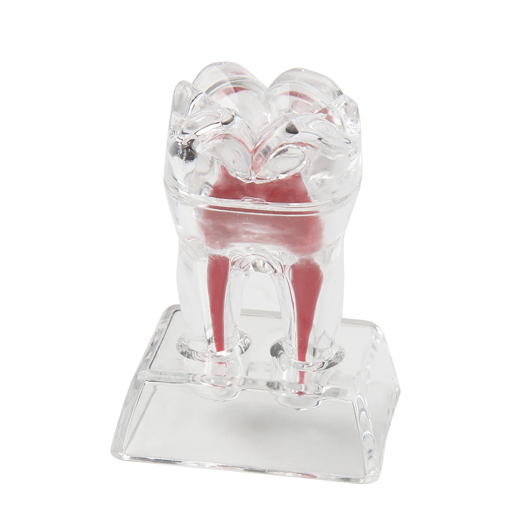 Dental Model Decomposable Dental Model Transparent Dental Teaching Model Transparent Small Ornament