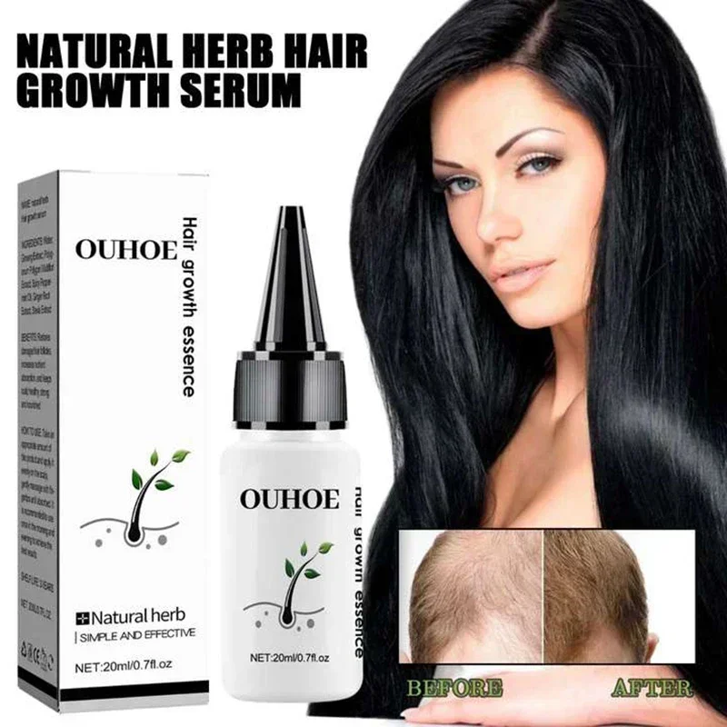 

Fast Hair Growth Essential oil Promoter Hair Loss Hereditary Seborrheic Alopecia Treatment For Hair Growth Essence Natural