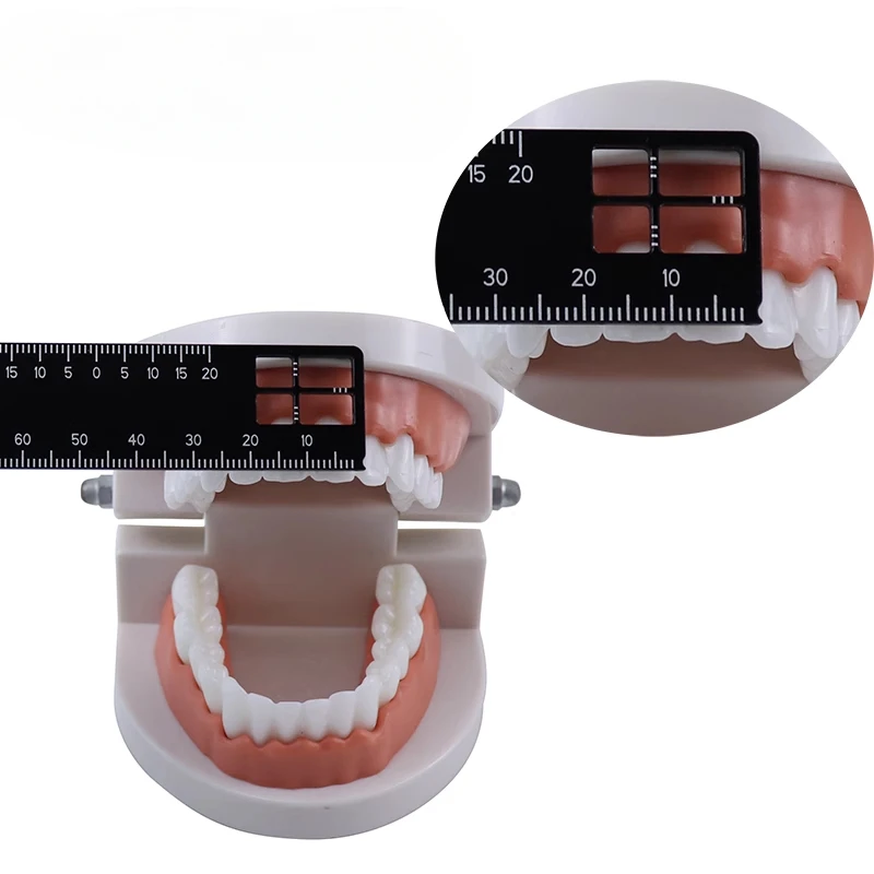 1Pcs Dental Precision Measuring Ruler Dentistry Medical Instruments Gauge Tool for Photography Dentista Material Oral Clean - Image 3