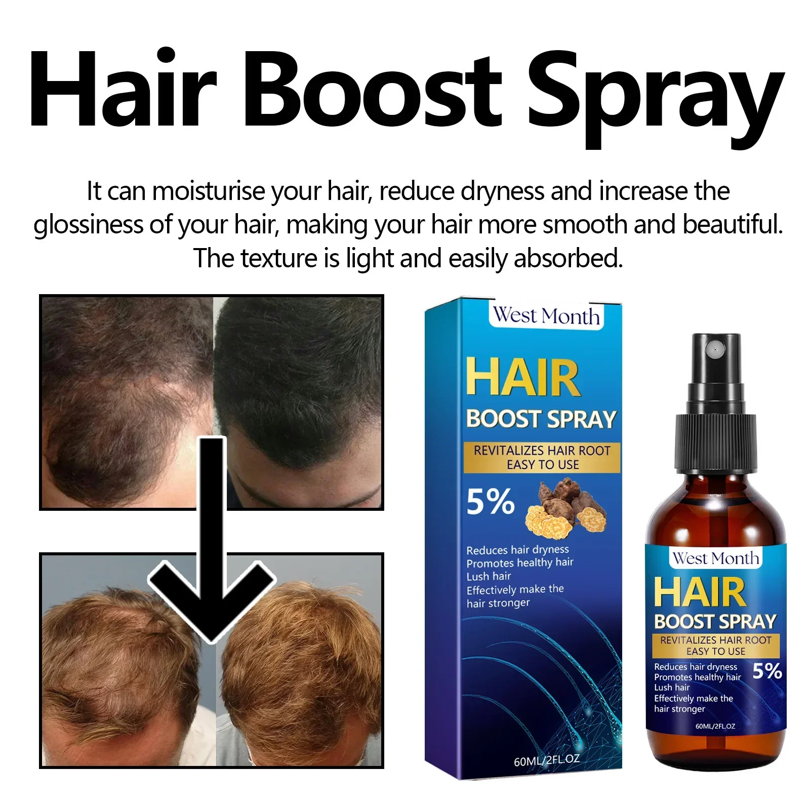 Spray Strong and Firm Hair Growth for Men - Ultimate Boost Hair Growth Treatment with Natural Ingredients Beard