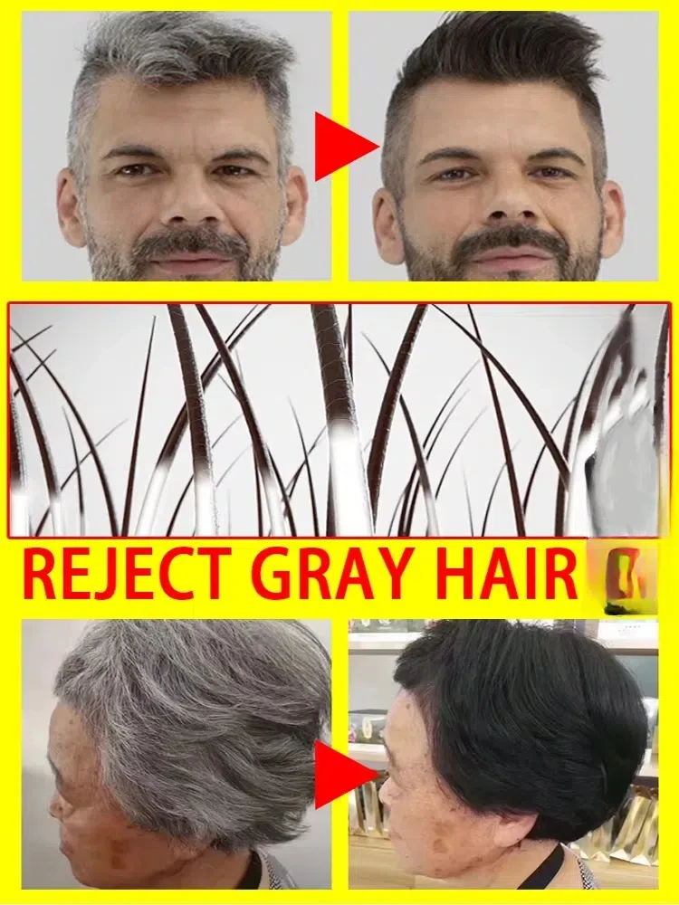 Natürliches Anti-Grau-Haarserum |   Nährende Haarpflege-Rare – repariert weißes und dunkelndes Haar