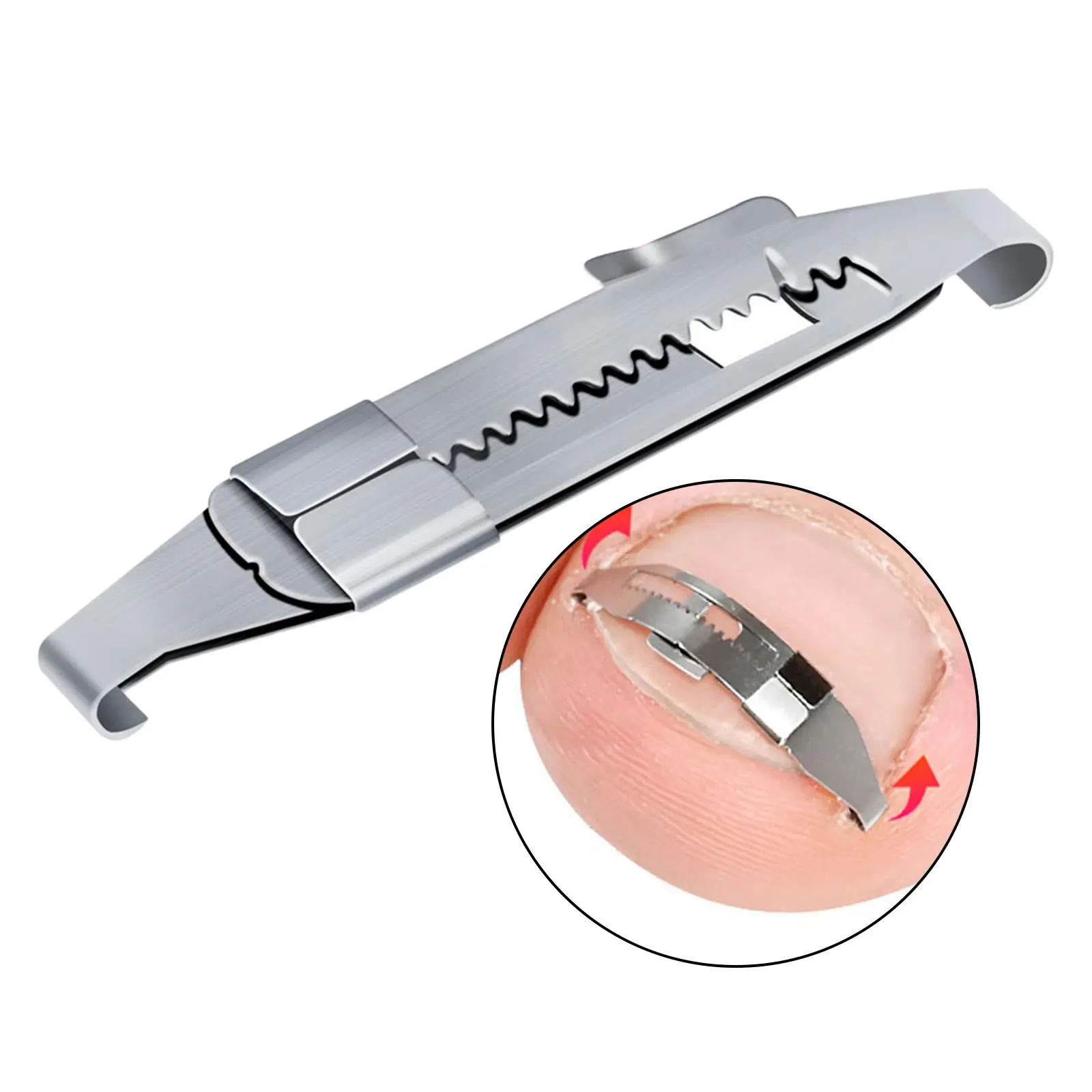 Ingrown Toenail Corrector Toenail Lifter Recover Top Grade Steel Foot Care