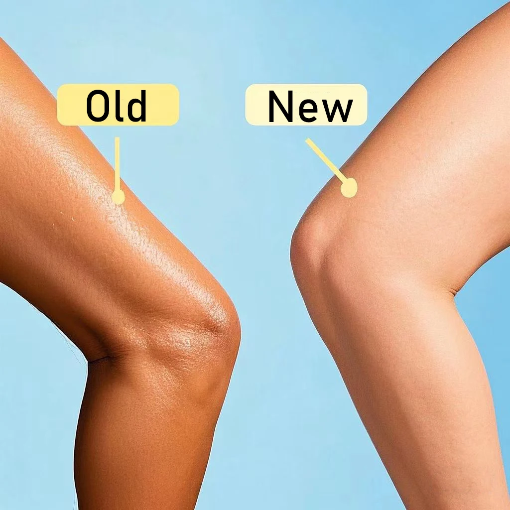 تقشير تقشير TCA احصل على مجموعات تقشير أسرع 20 + 30 + 35 5 مللي حمض الفاكهة + سائل تحييد قلوي خطة عامة #4