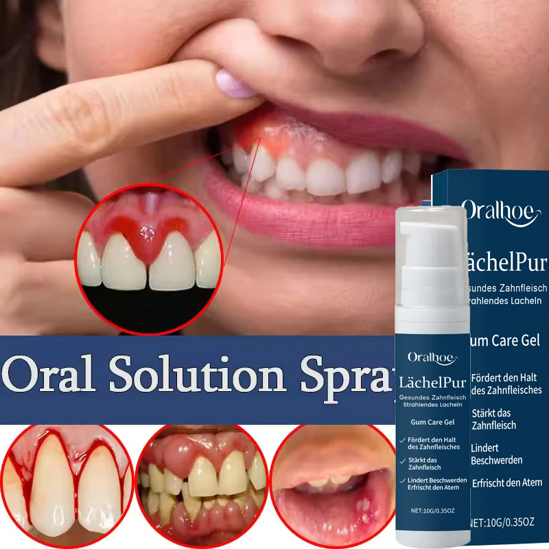 

Effectively Repair Gums Gel Relieve Receding Gum Regrowth Drops Serum Tooth Allergy Remove Dental Caries Plaque Stain Toothpaste