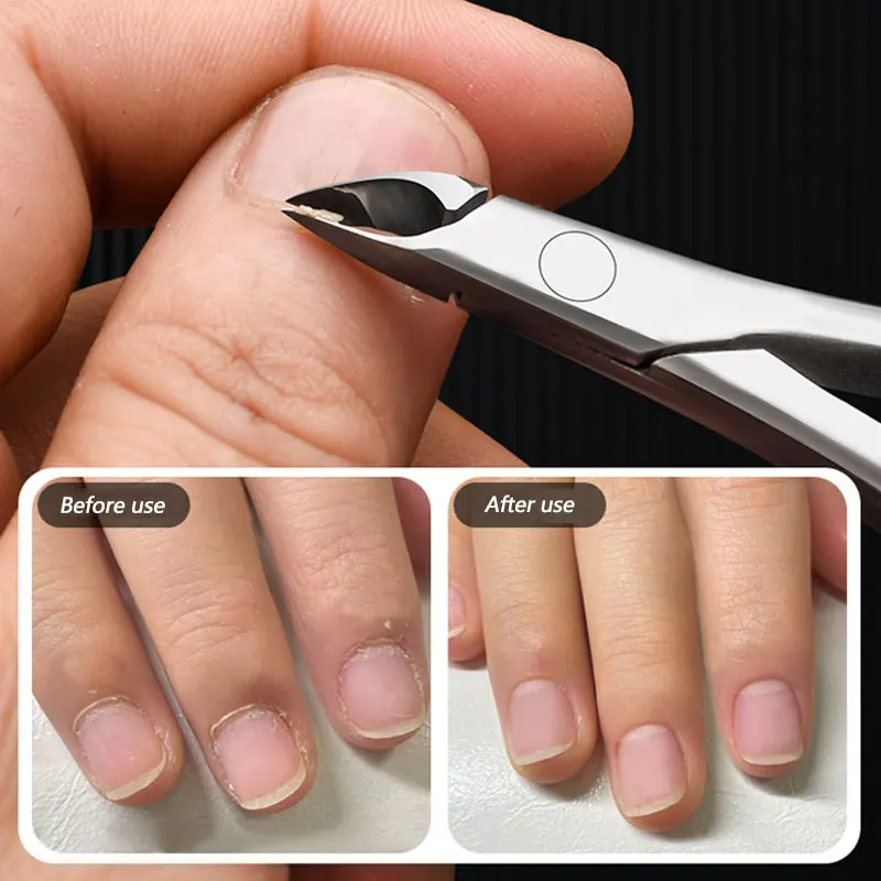Thumbnail 4 - #49 Nail Clippers List of Top Picks
