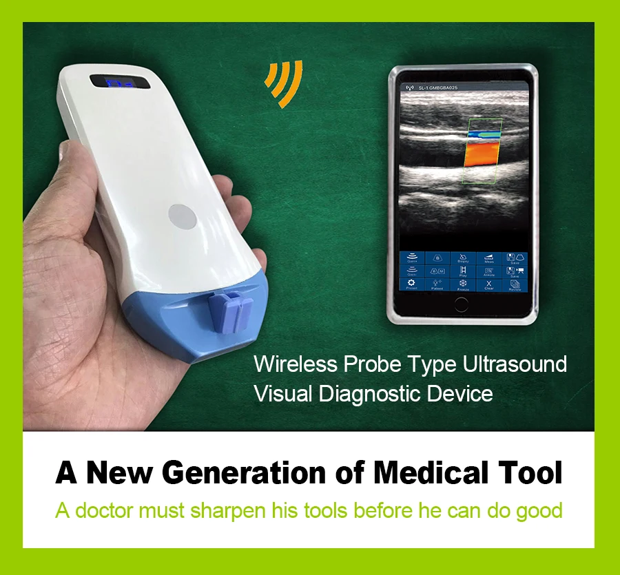 MC12 10/14Mhz portable pocket size wireless ultrasound usg transducer for MSK and vascular access