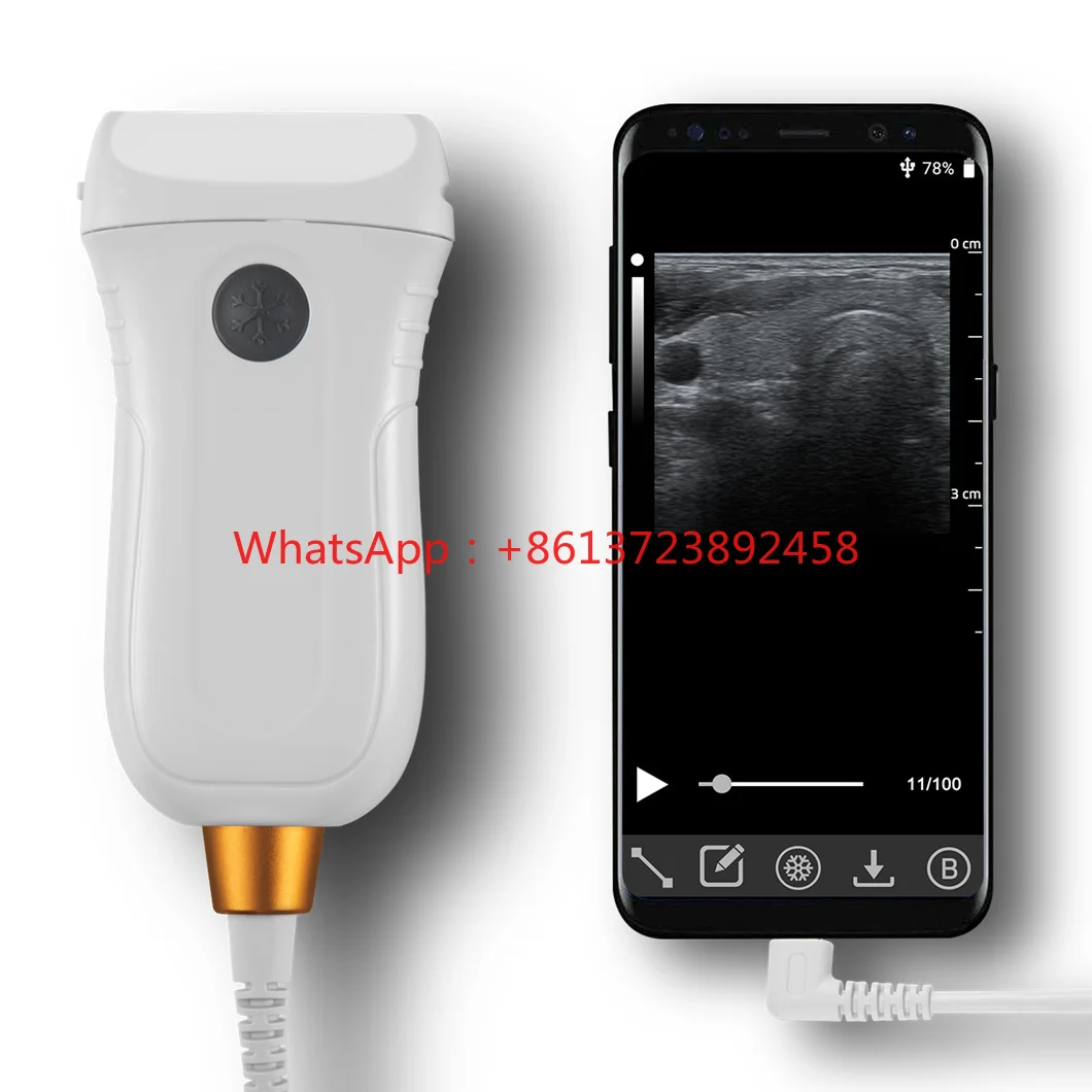 

Waterproof Veterinary Type C Portable Ultrasound Convex Linear Rectal Probe for Animal