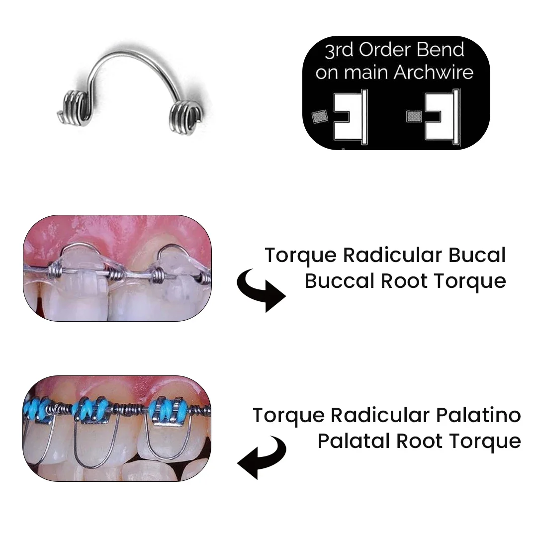 10Pcs/Bag Dental Orthodontic Torquing Springs Anterior Torque Spring Auxiliar de torque Warren Spring for Brackets Archwires