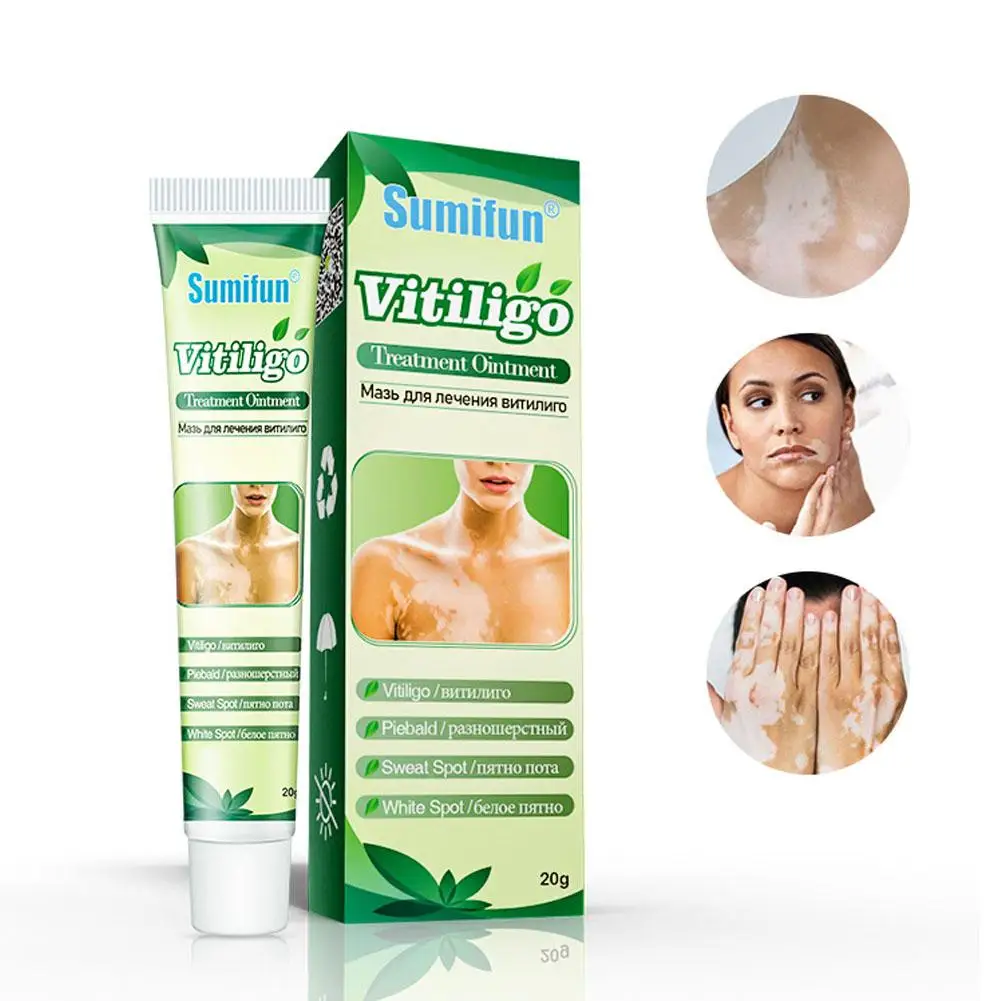 Vitiligo salep Herbal ekstrak, penghilang Ringworm putih Spot Vitiligo perawatan penghilang kulit Vitiligo krim menghilangkan C0P1