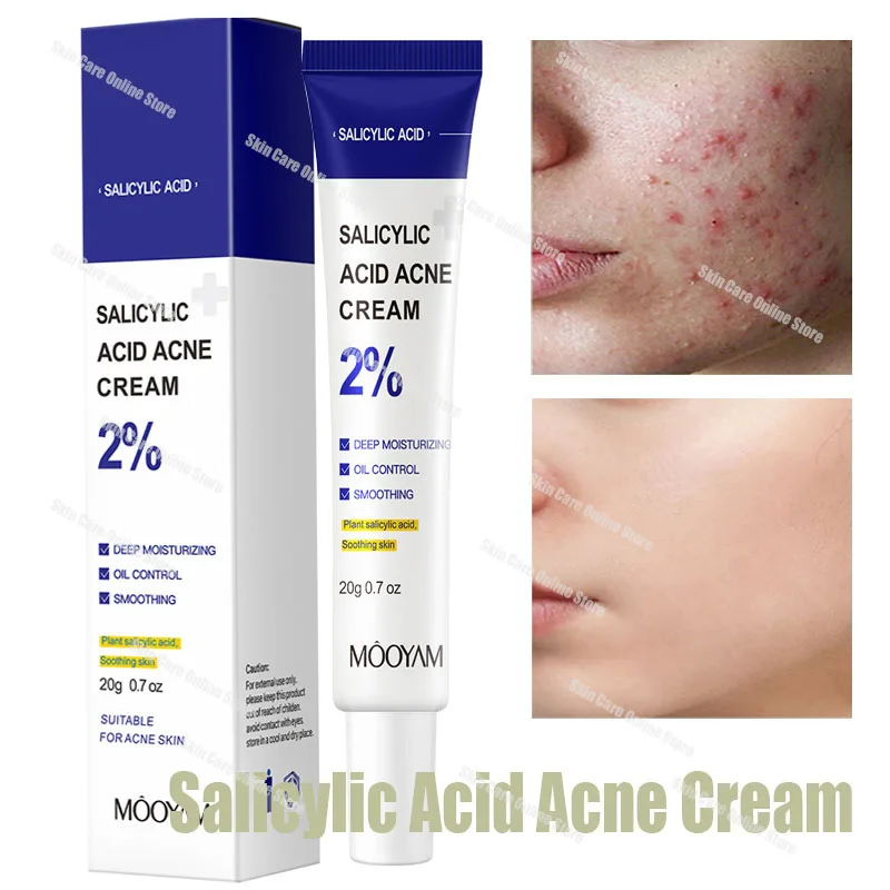 

Salicylic Acid Acne Treatment Cream Acne Remover Face Cream Remove Deep Acne Scars Gel Oil Control Shrink Pores Blackheads Care