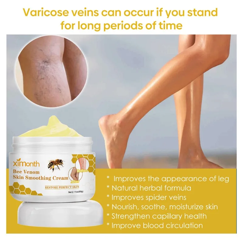 발톱무좀 Bee Venom Venous Repair Cream Relieves Leg Pain and Swelling, Smoothes Vascular Protruding Veins Personal Health Care