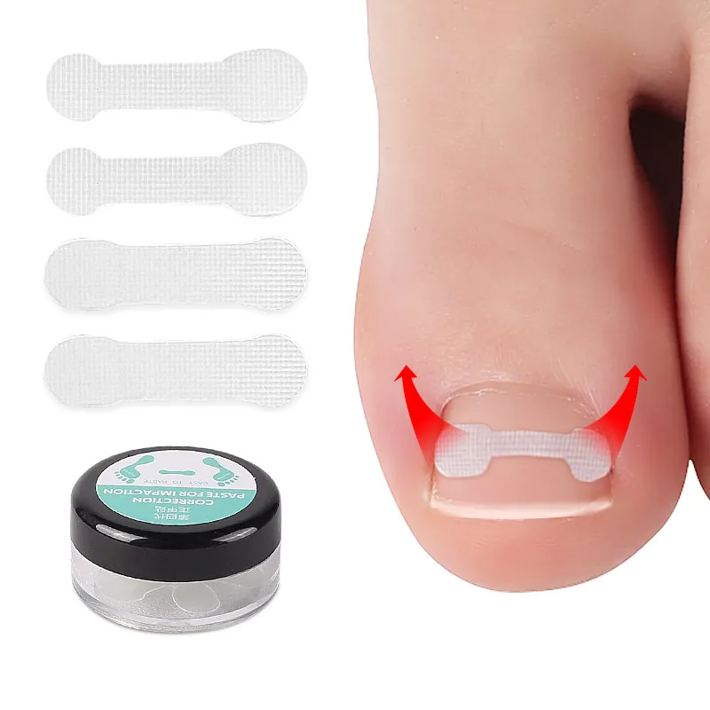 10PCS Ingrown Toe Nail Ingrown Toenail Correction Tool Elastic Patch Sticker Straightening Clip Brace Pedicure Tools