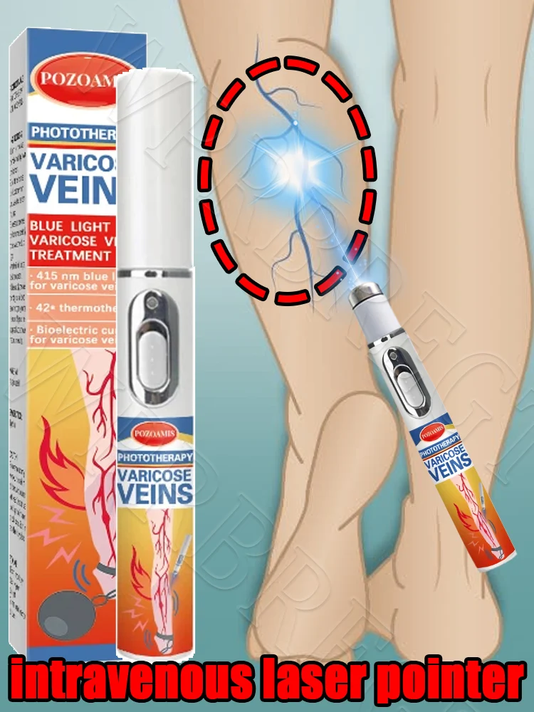 静脈瘤治療、レーザーポインター