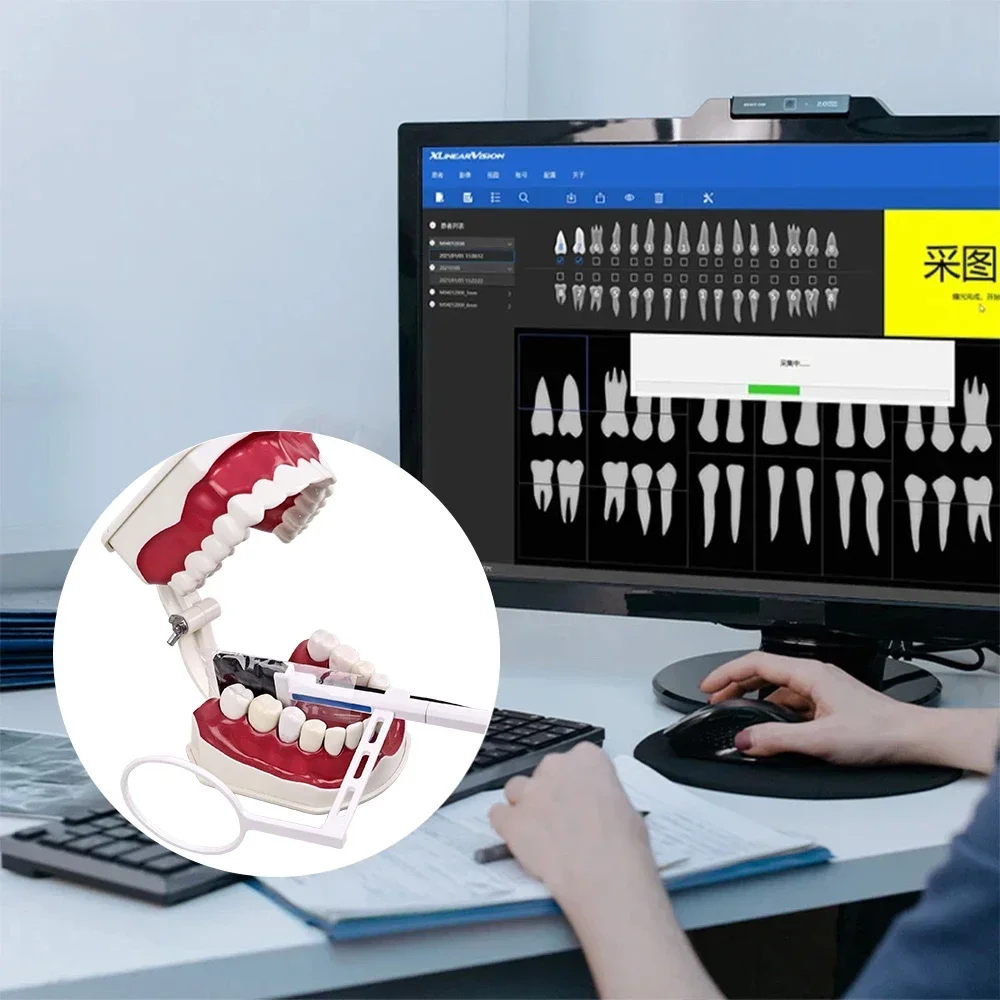 مستشعر الأسنان الأشعة السينية الاستشعار الرقمي آلة التصوير كاميرا داخل الفم الرقمية HD نظام التصوير الفم الطبية فيلم معدات طب الأسنان