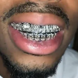 RACHELZ 8/8 Sugar Cubic Zircon Teeth Grillz Hip Hop Iced Out CZ Stone Tooth Caps For Men Women Jewelry Dental Grills