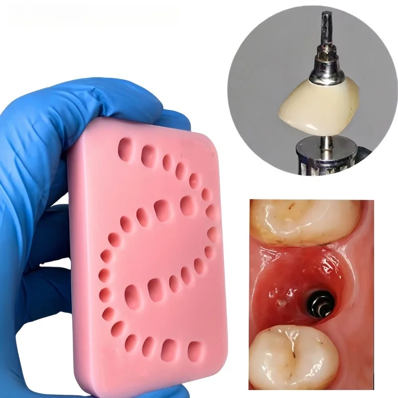 1Pcs Customized Dental Implant Sleeve Molding Model Dental Implant Practice Mold High Precision Digital Rapid for Multiple Impla