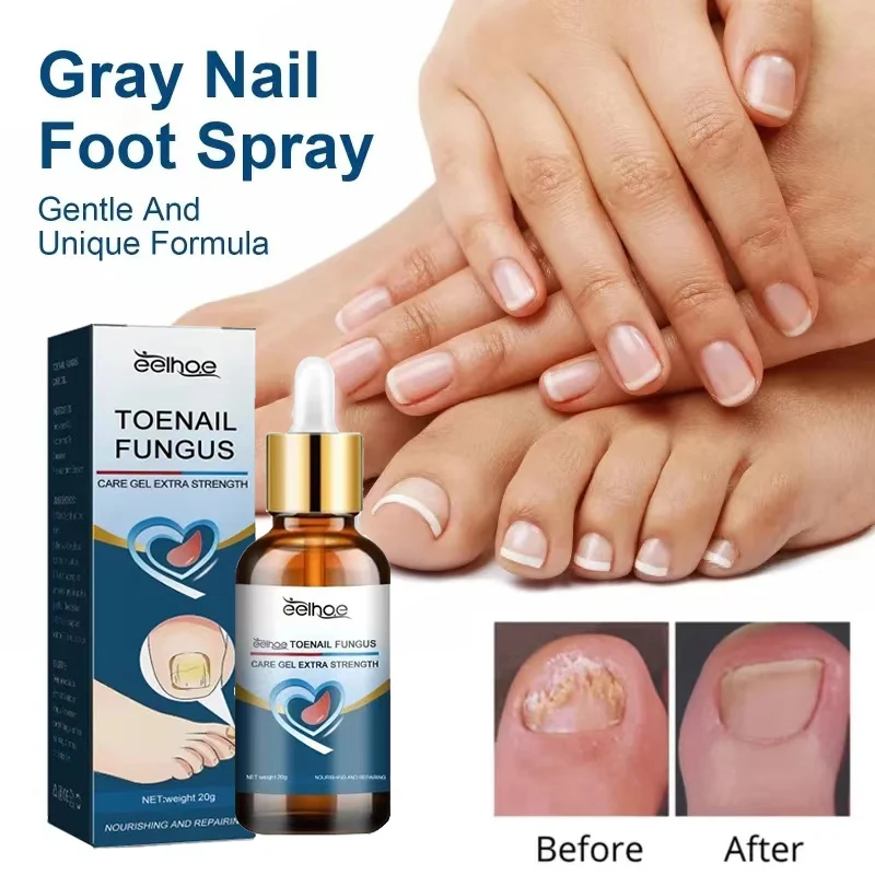 

Effective Nail Fungus Treatment Cream Foot Toe Nail Fungus Removal Serum Anti-infection Repair Gel Care