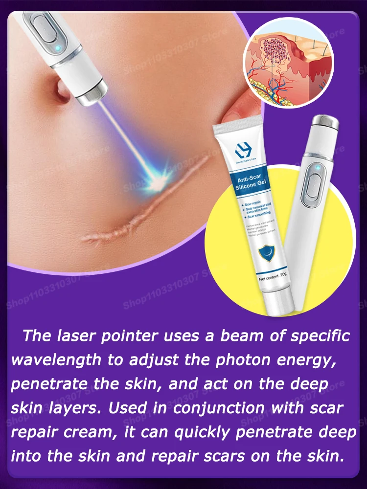 Laser whitening for Repair Scars