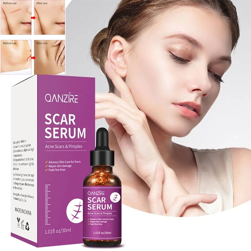 

Scar essence can replenish water and moisturize scars improve acne marks make the whole body smooth and tender Skincare