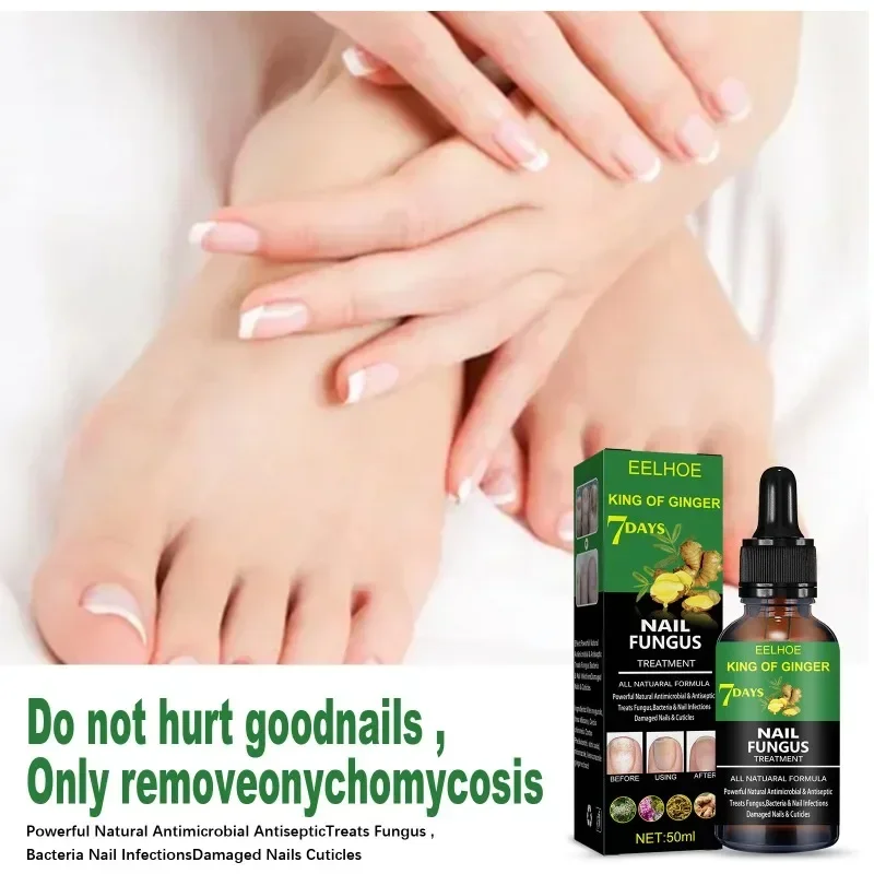 Efficient Nail Repair Solution Treating Cracked Discolored Nails Gray Foot Care Toe Nail Sterilization Gel Nourishing Essence