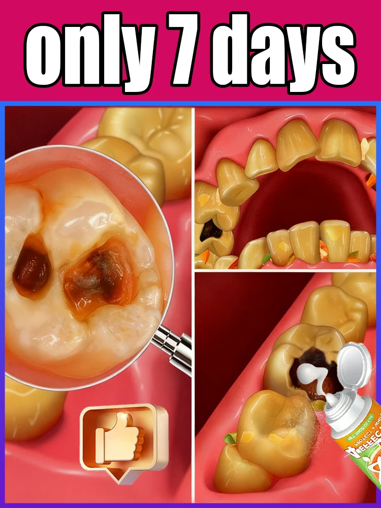 

Sᴄɪᴇɴᴛɪғɪᴄ Rᴇᴘᴀɪʀs Cᴀᴠɪᴛɪᴇs, Cʟᴇᴀɴs Pʟᴀᴏ̨ᴜᴇ, Wʜɪᴛᴇɴs Tᴇᴇᴛʜ