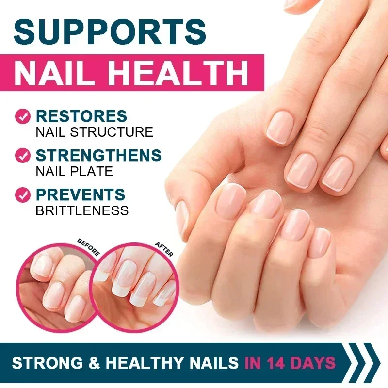 Colágeno múltiple: salud de la piel, las articulaciones, el cabello, las uñas, antioxidante - Tipos de colágeno I, II, III, V y X