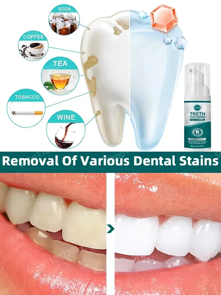 

Let you no longer worry about dental problems
