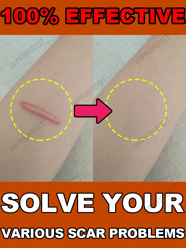 

Скажи нет в невлем коже