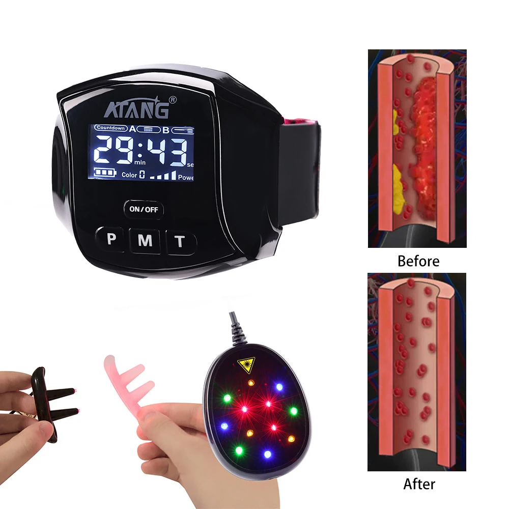 

Diabetic Therapy Laser Therapy Physiotherapy Watch Diabetic High Blood Pressure, High Blood Sugar