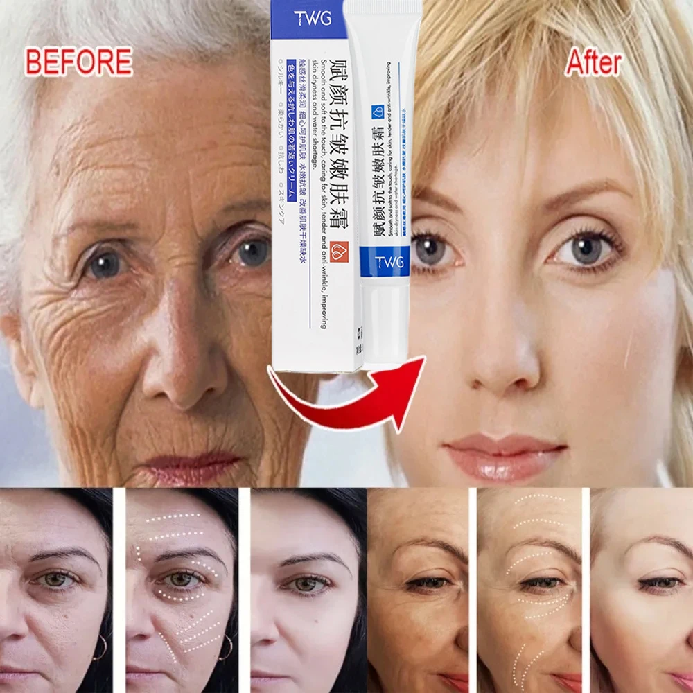 Retinol Wrinkle Removing Face Cream Anti-Aging Firming Lifting Fade Fine Lines Moisturizing Brighten Skin Care Korean Cosmetics