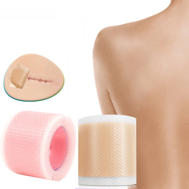 1 Roll  Silicone Gel Scar Sheets Self-Adhesive Scar Cover Tape Reusable And Effective Skin Care Strips Waterproof And Breathable