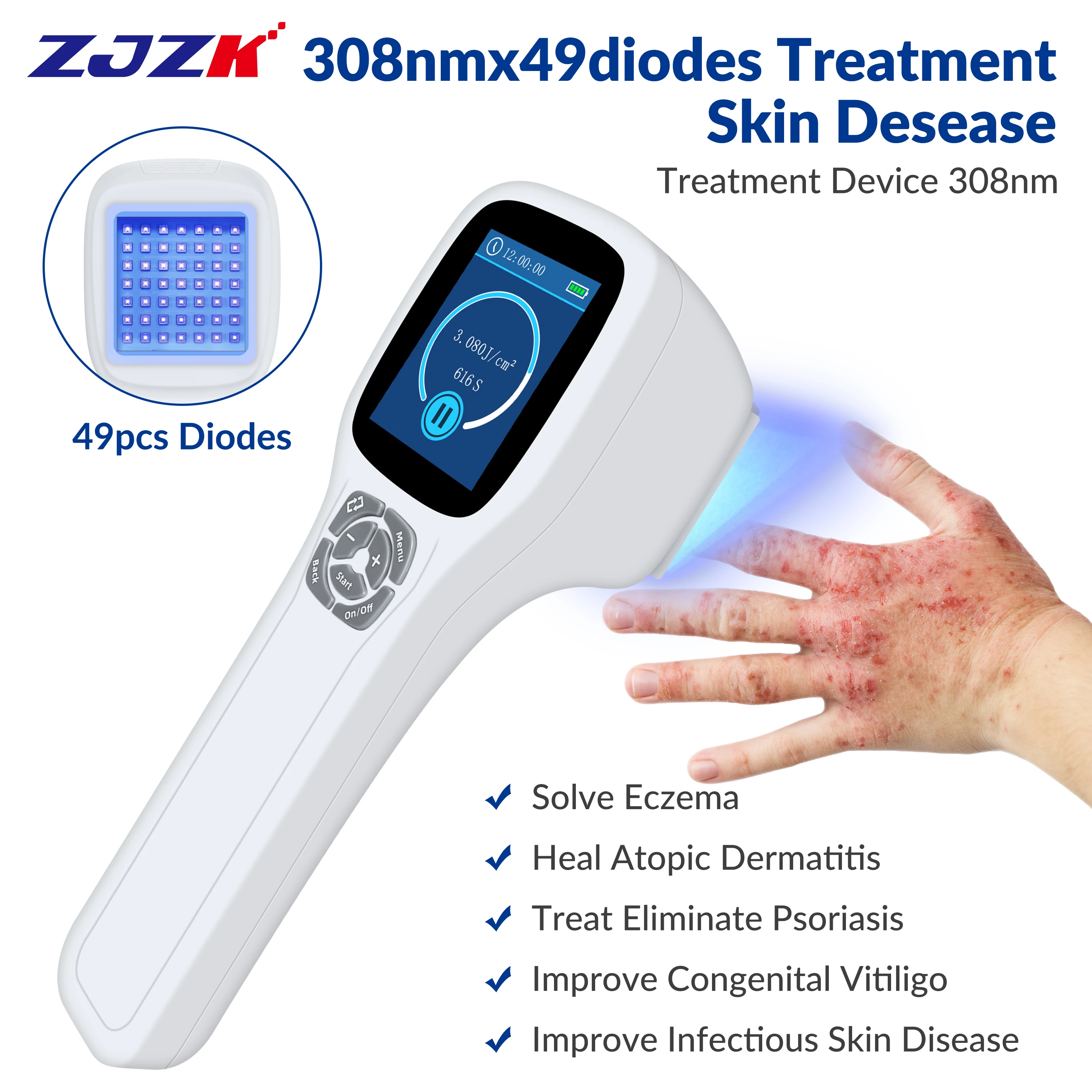 

ZJZK Psoriasis Home Treatment Light Therapy Psoriasis Light Machine UV Light 308nmx49diodes For Skin Conditions Vitiligo