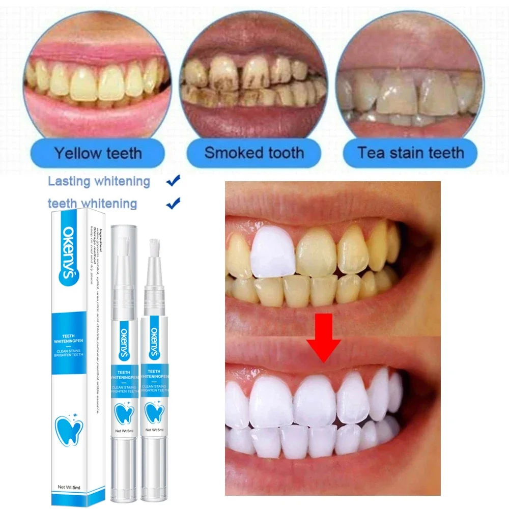 Whitening Tooth Pen Remove Smoke Stains, Coffee, Tea, Freshen Dad Breath, Oral Hygiene, Dental Care Essence, Teeth Whitening Gel