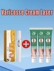 Laser Therapy For Varicose Vein Treatment Effective Relieve Legs Dilated Vasculitis Phlebitis Improve Circulation Blue Light Pen