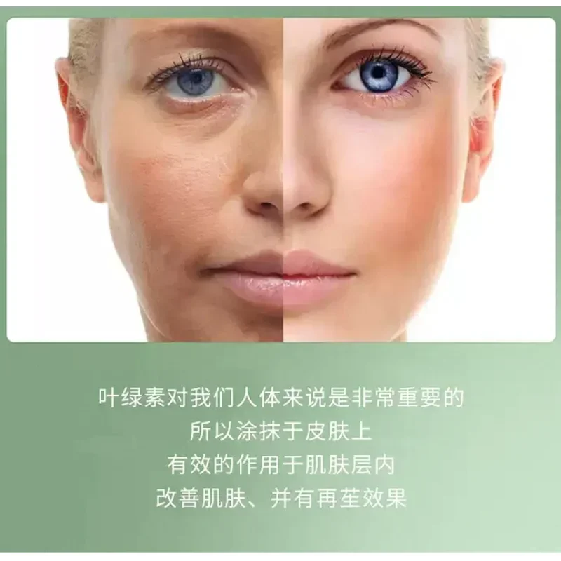 Chlorophyll Skin Rejuvenation Set Reduce Acne Marks Improve Skin Moisturizing Nourishing Brightening Anti-wrinkle Skin Care Set