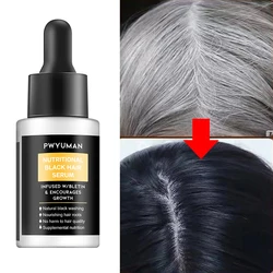 Gray White Hair Treatment Serum Liquid White To Black Natural Color Repair Nourish Essential Oil Anti Loss Men Women Hair Care