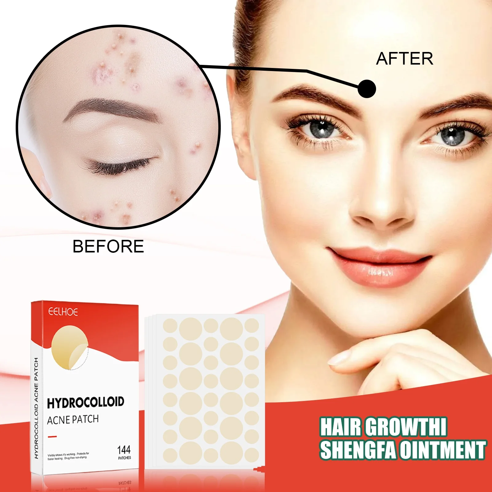 Colloidal Acne Patch For Facial Invisible Makeup, Closed Mouth Acne Treatment, Waterproof And Breathable Facial Care