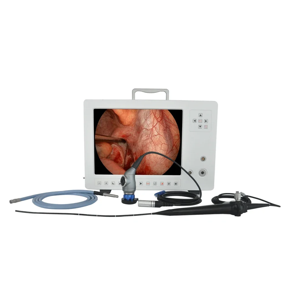 YKD-9610-5 Multi-Functional HD Flexible Endoscope Rigid Endoscopy Imaging Endoscopic System