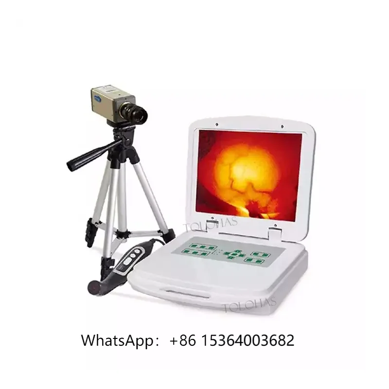 

LHF8100A Medical Infrared Mammary Gland Inspection Device Breast Examination Diseases Diagnostic Equipment for Breast Cancer