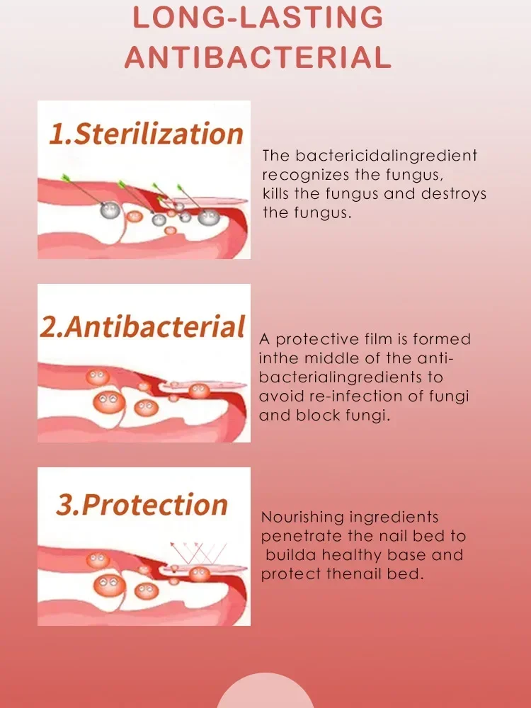 Nail Fungus Treatment Serum Toe Fungal Repair Products Hand Foot Care Removal Gel Anti Infection Onychomycosis Paronychia