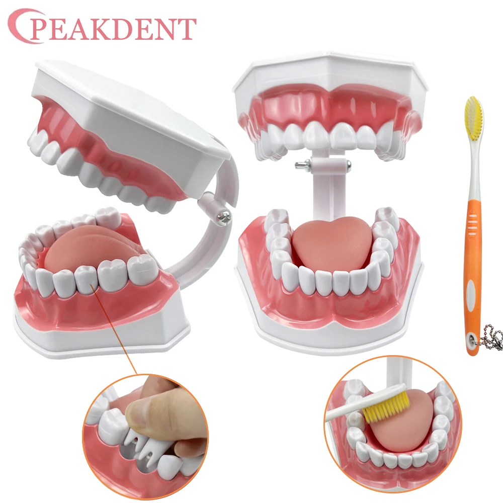 4 volte Modello di denti di carie Modelli di comparazione Decomposizione di carie Modello di laboratorio odontoiatrico dissolvato per il dentista Studio e ricerca