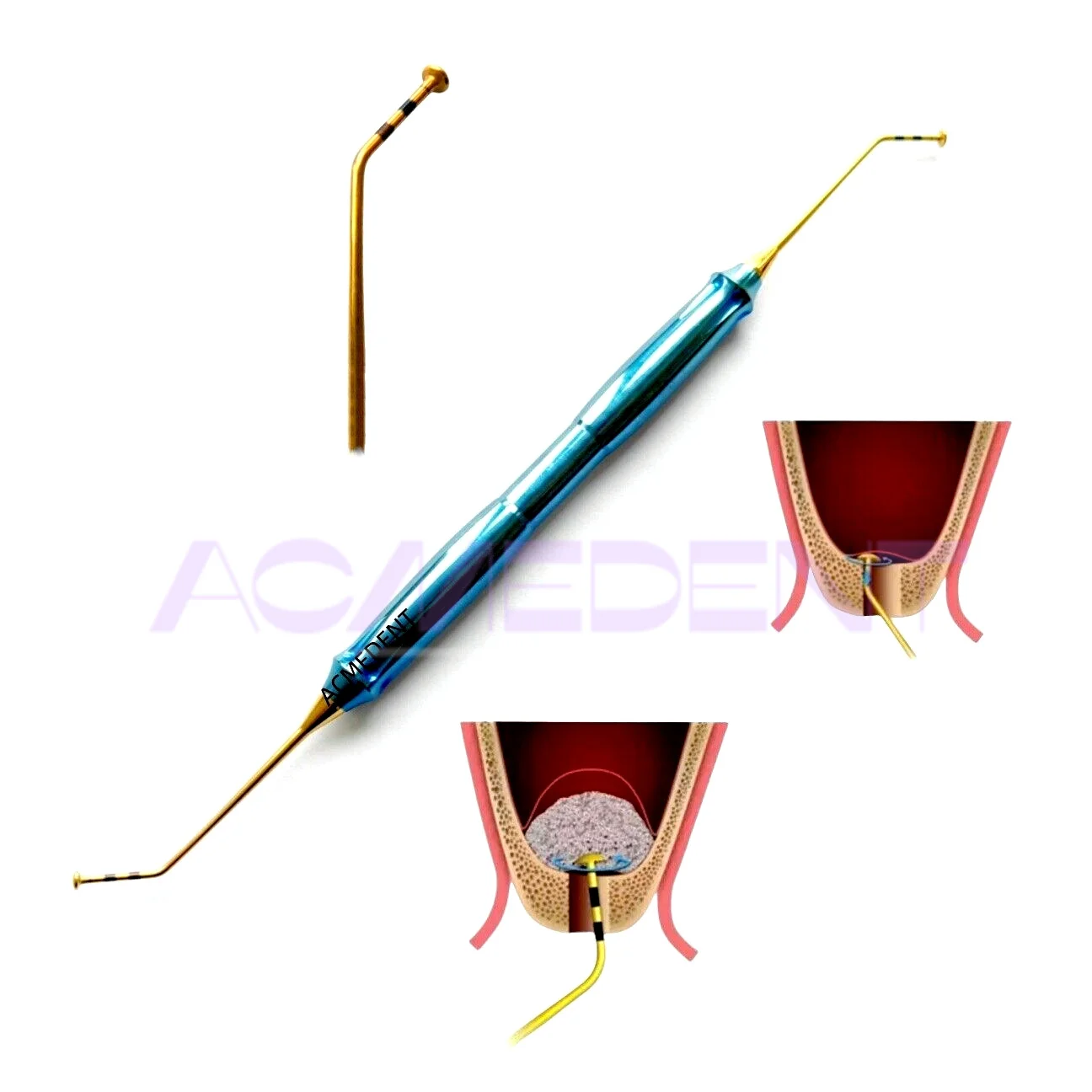 

Dental Tool Dome Handle Sinus Lift Release Membrane Elevator Crestal Approach