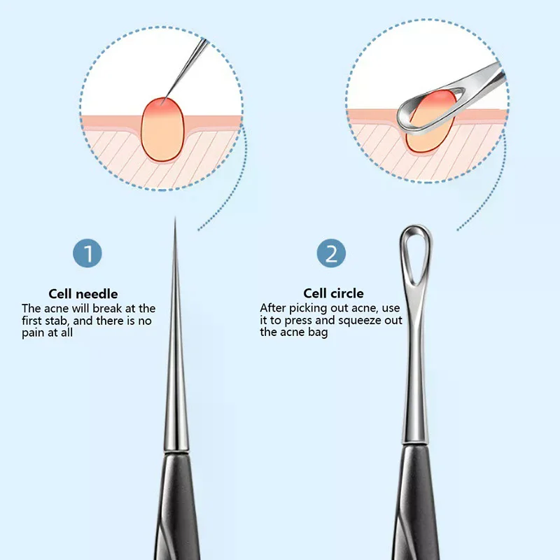 Acné aiguille points noirs pince dissolvant Extraction pores tête noire nettoyant visage soins de la peau nettoyage en profondeur aiguille outils