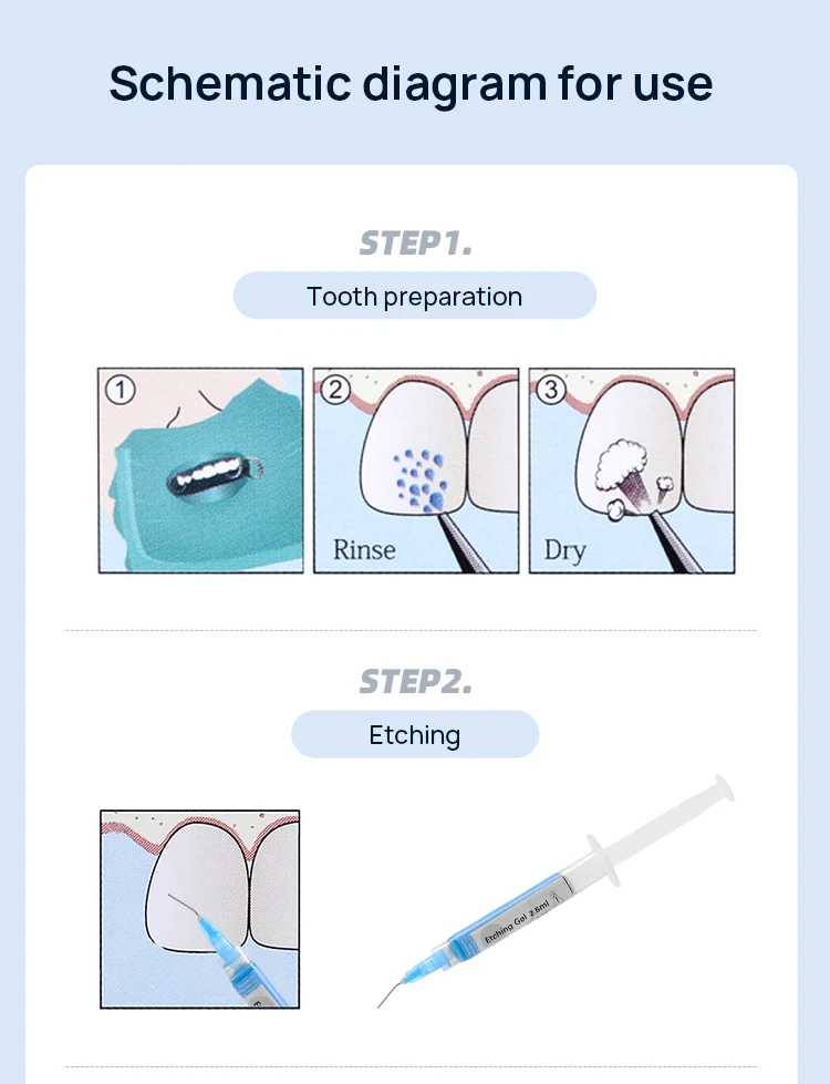 AZDENT Dental Orthodontic Light Cure Adhesive Bonding Brackets Braces Ortho-Bonding Primer Paste Kit Zahnheilkunde – Detail 4